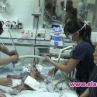 Делиха сиамски близнаци 20 часа в Чили