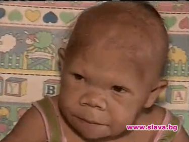 30-годишна жена изглежда като 9-месечно бебе 