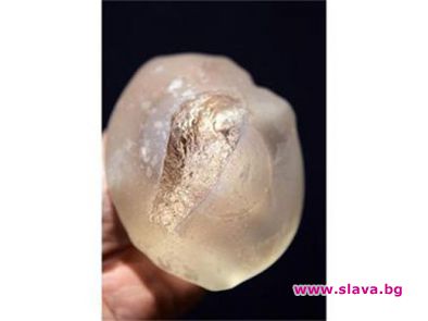 Над 2000 българки с гърмящи импланти