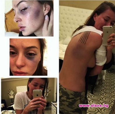 Водещият на „Мис Русия” преби гаджето си манекенка