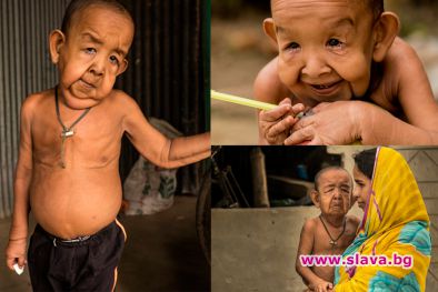 Историята на истински Бенджамин Бътън