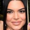 Нападнаха Кендал Дженър заради лоша кожа