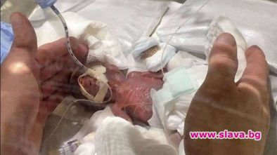 Бебе тежащо само 245 грама оцеля като по чудо