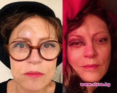 Сюзън Сарандън с насинено око