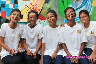 Жертви на атаки с киселина въртят култово кафене