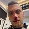 Сценична боя е по лицето на бития Флоров: А. Стефанов