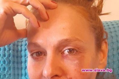 Наша актриса си разби лицето при битов инцидент