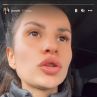 Ето какво си причини Зорница от "Игри на волята" на лицето