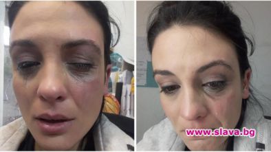 Ето коя певица призна, че е била пребита като куче