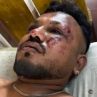 Чудо на седалка 11А: какво знаем за единствения оцелял в катастрофата на Air India Вишваш Кумар Раме