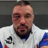Валентинов се извини: Не съм разбрал, че отхапвам ухото на Митко