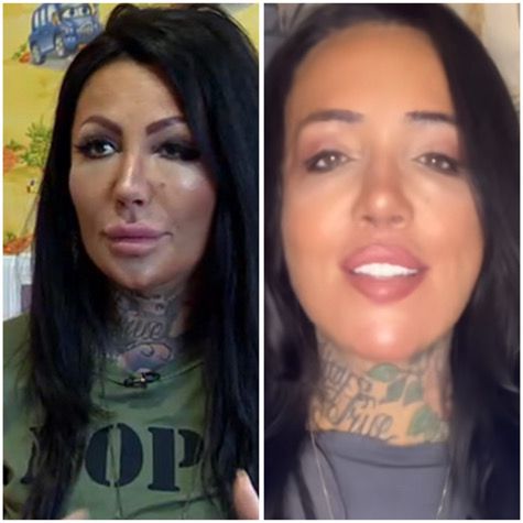 Никита Джонсън махна филърите и стана психолог в TikTok