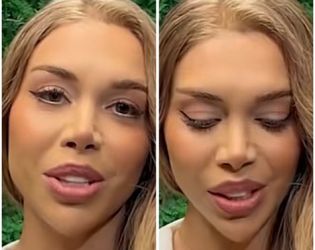 Шермин с нови пластики след “Ергенът”