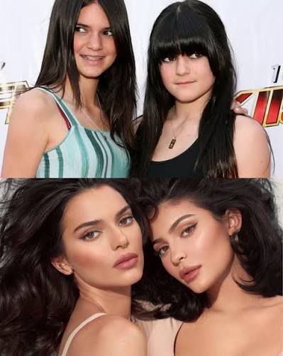 Кендъл Дженър твърди, че НИКОГА не е имала пластични операции – но феновете не ѝ вярват