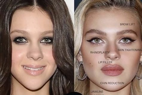 Никола Пелц преди