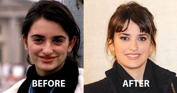 И холивудските звезди си правят пластики, но не като нашите