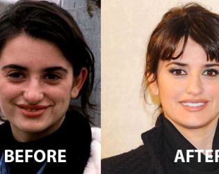 И холивудските звезди си правят пластики, но не като нашите